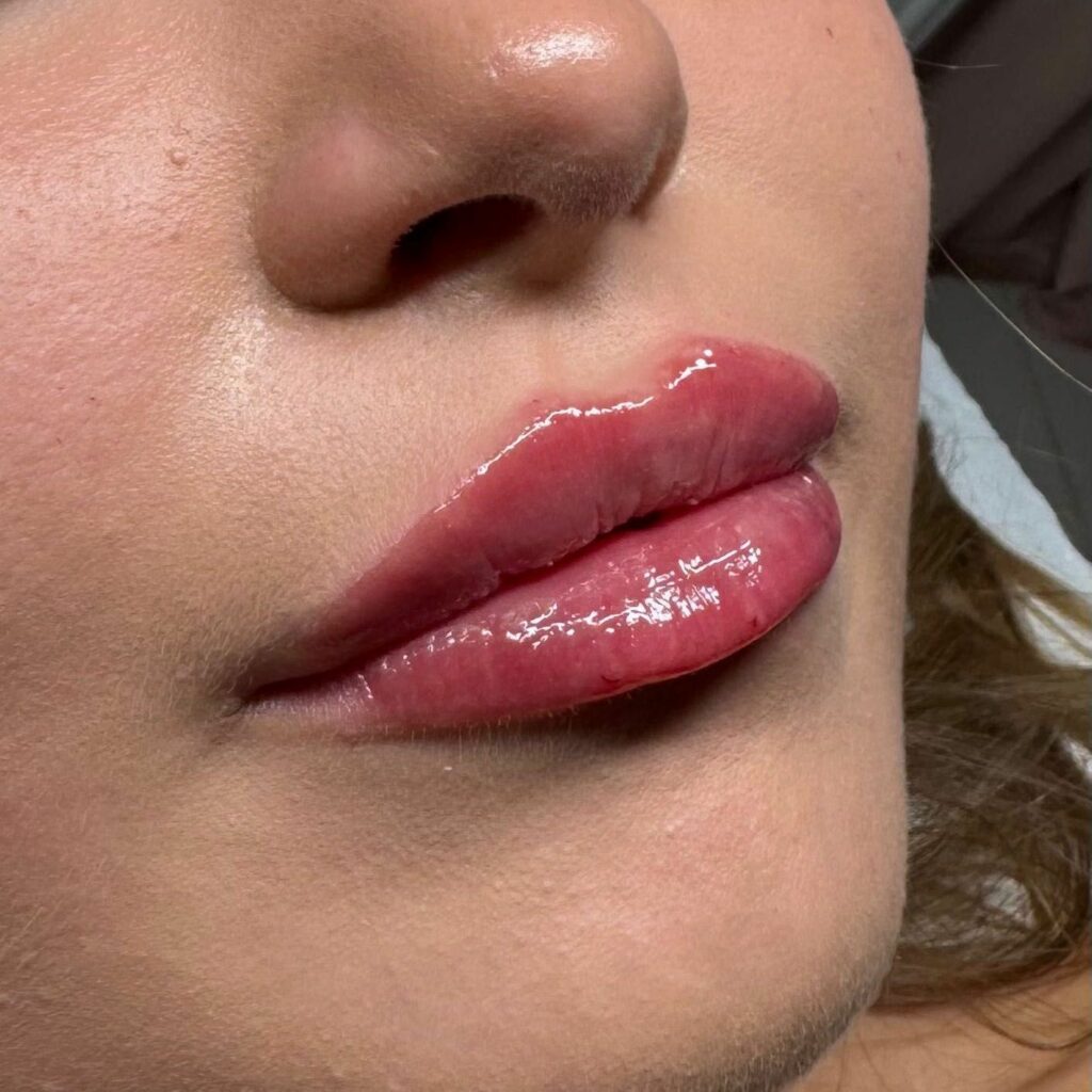 Modelowanie ust — naturalny efekt